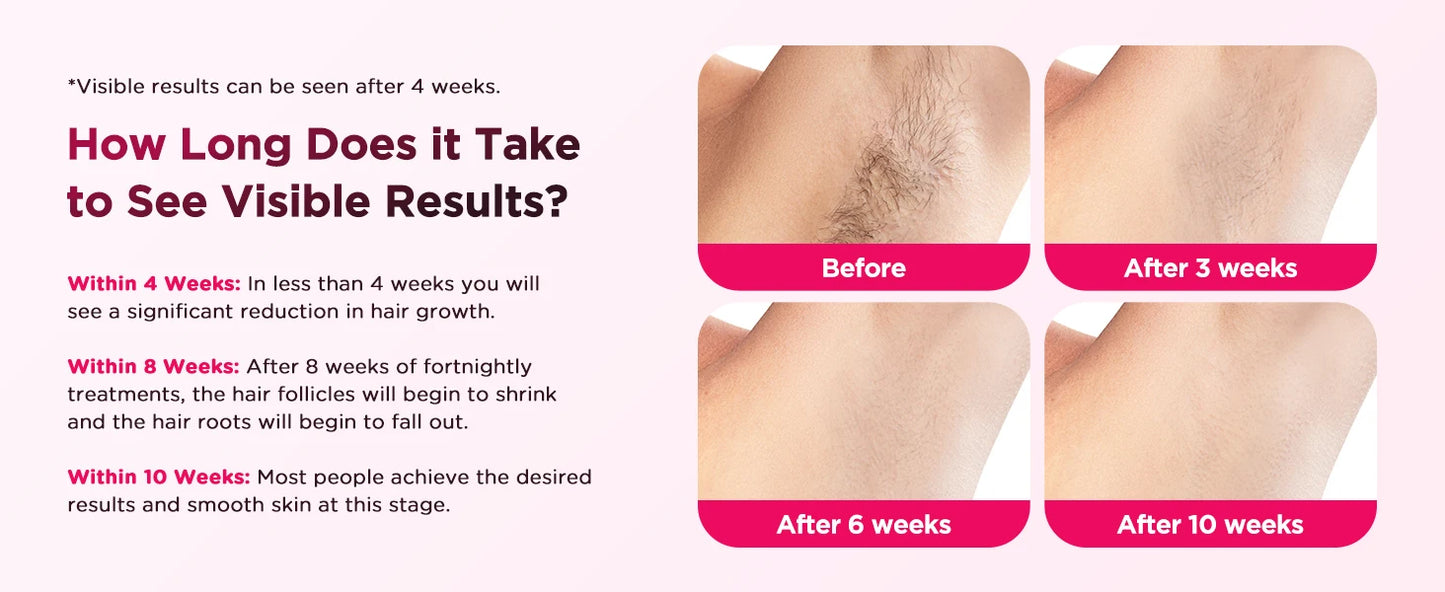 πAt-Home IPL Laser Hair Removal Handset β Safe, Painless & Long-Lasting Results