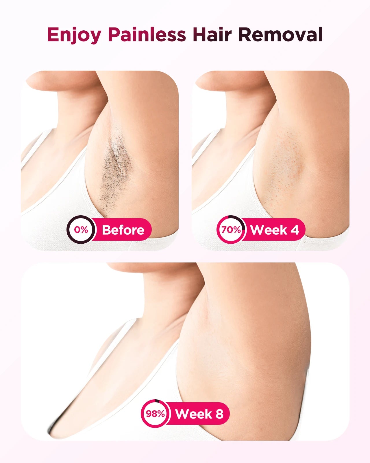 πAt-Home IPL Laser Hair Removal Handset β Safe, Painless & Long-Lasting Results