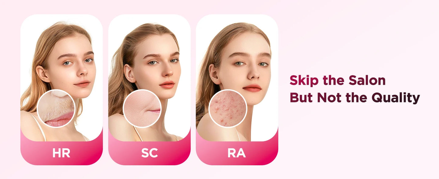 πAt-Home IPL Laser Hair Removal Handset β Safe, Painless & Long-Lasting Results
